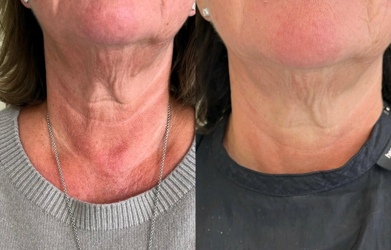 Wendy Freeman Results