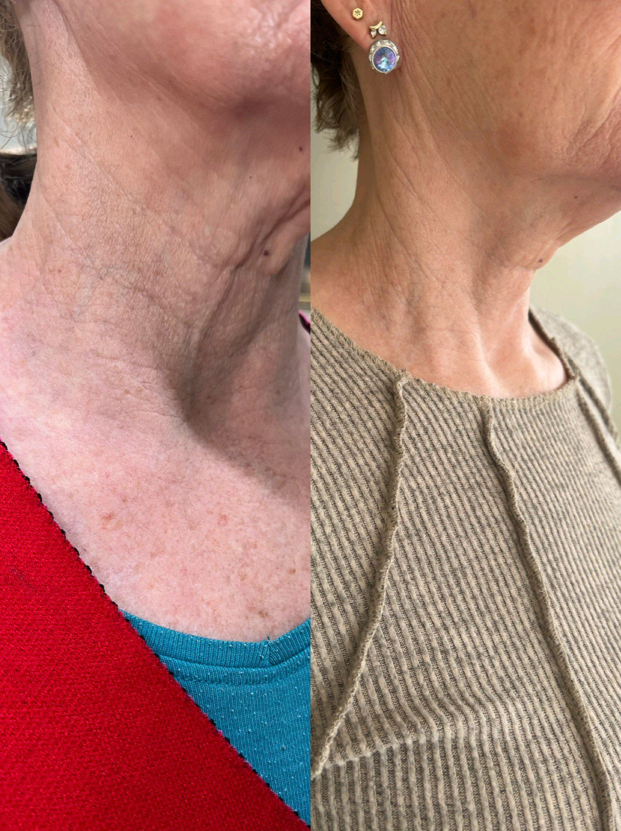 Wendy Freeman Results