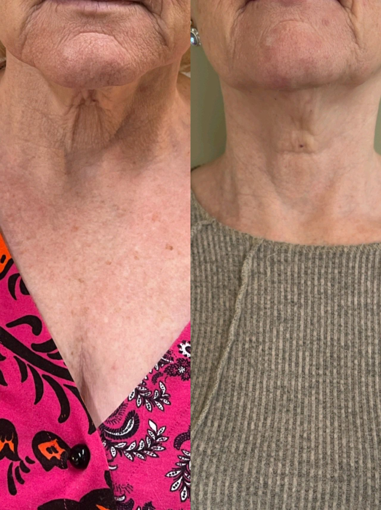 Wendy Freeman Results