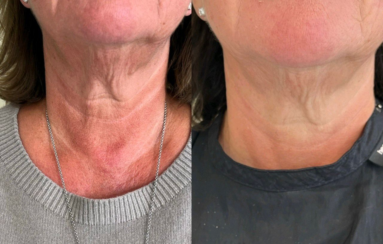 Wendy Freeman Results